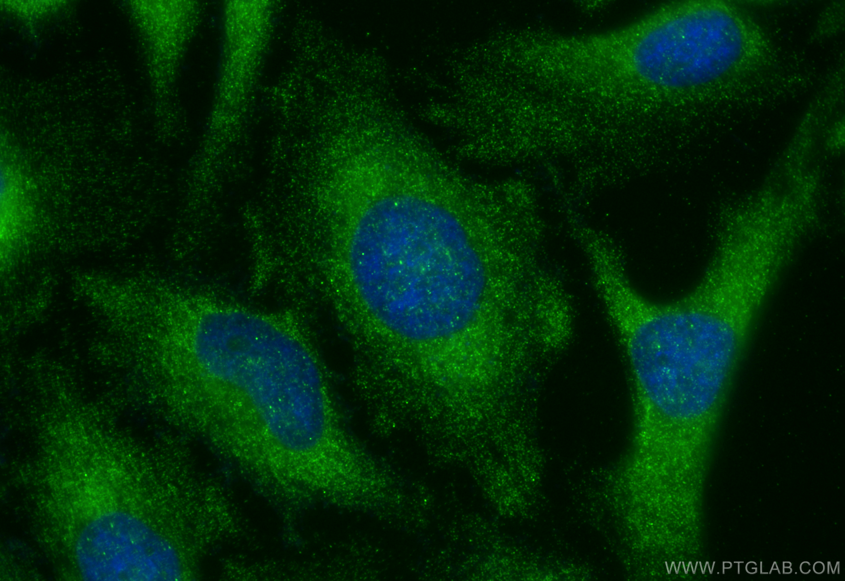 Immunofluorescence (IF) / fluorescent staining of HeLa cells using Sestrin 2 Polyclonal antibody (10795-1-AP)