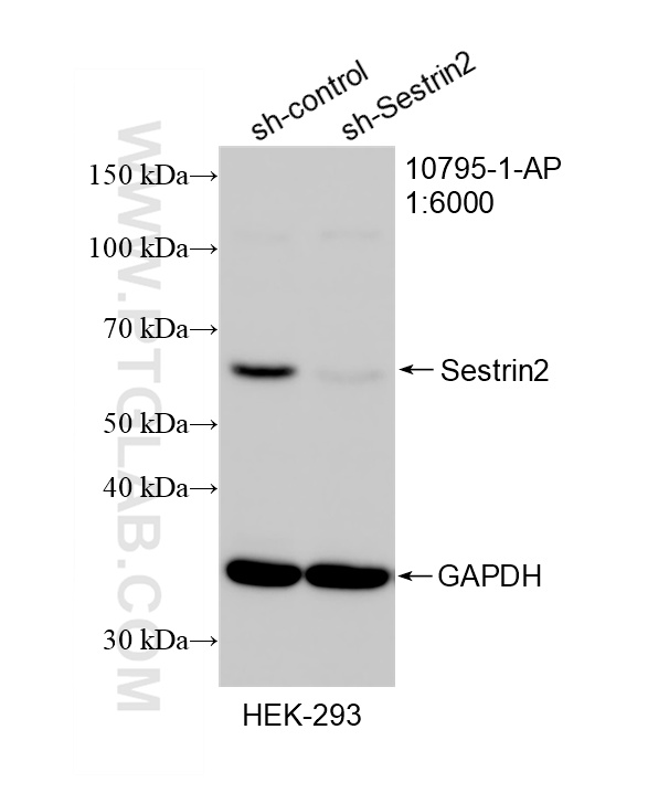 Western Blot (WB) analysis of HEK-293 cells using Sestrin 2 Polyclonal antibody (10795-1-AP)