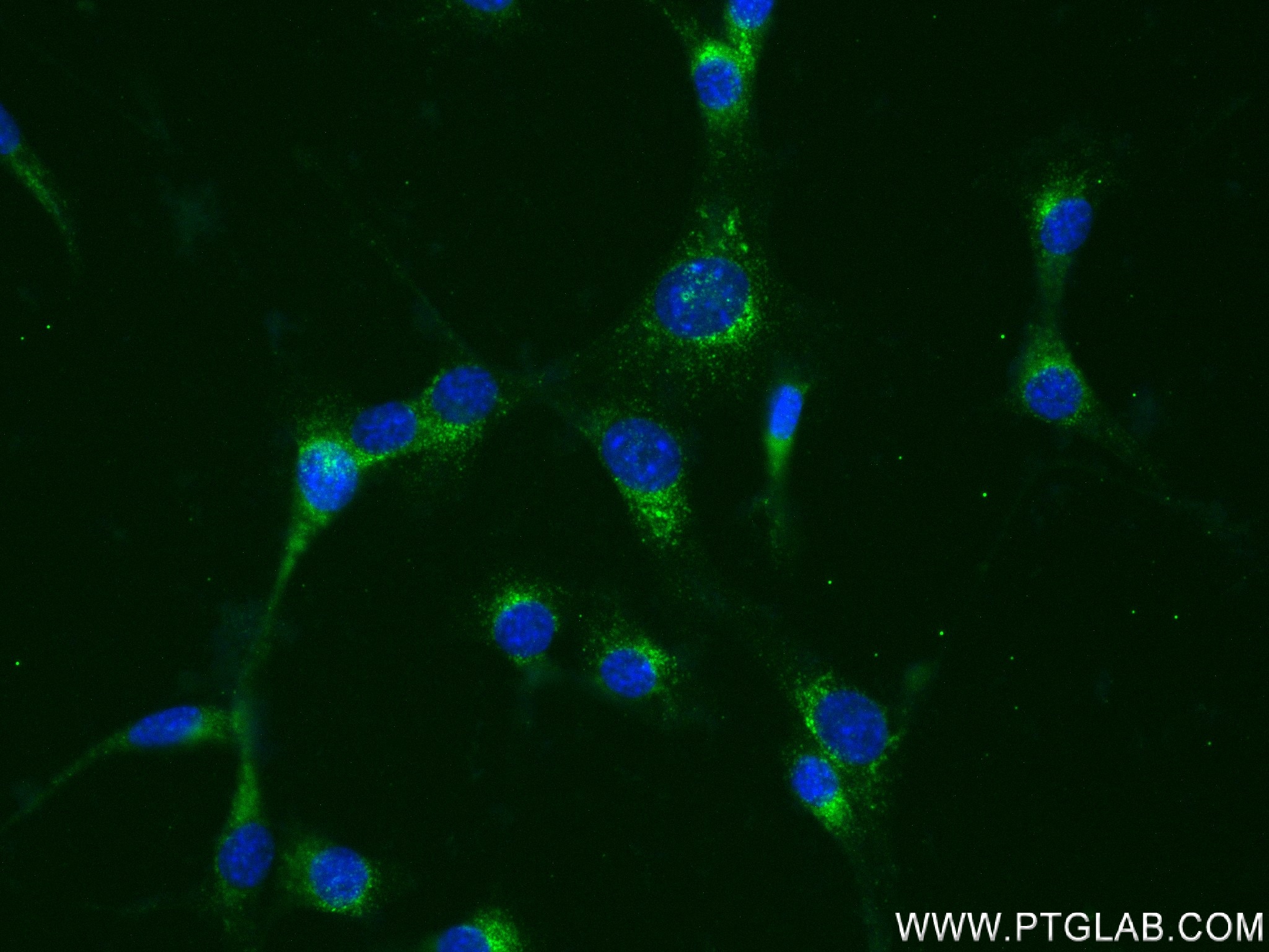 Immunofluorescence (IF) / fluorescent staining of NIH/3T3 cells using Shh Recombinant antibody (83280-1-RR)