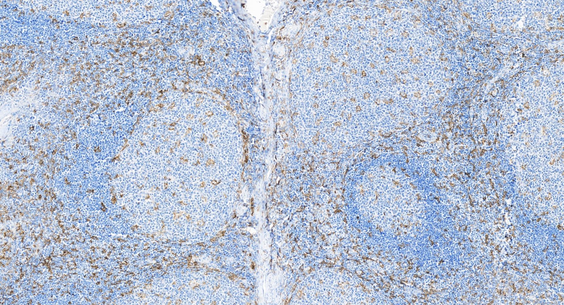 Immunohistochemistry (IHC) staining of human tonsillitis tissue using Siglec-7/CD328 Recombinant antibody (84253-4-RR)