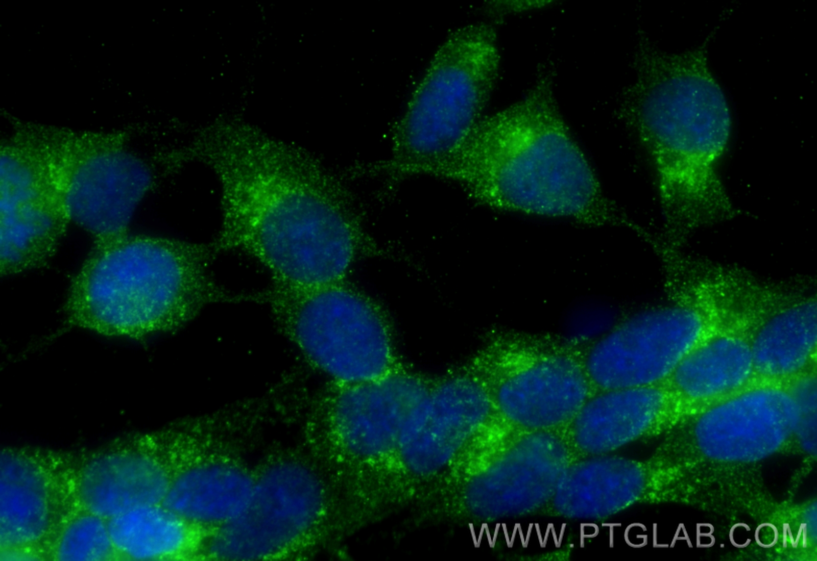 Immunofluorescence (IF) / fluorescent staining of SH-SY5Y cells using Sortilin Monoclonal antibody (68007-1-Ig)