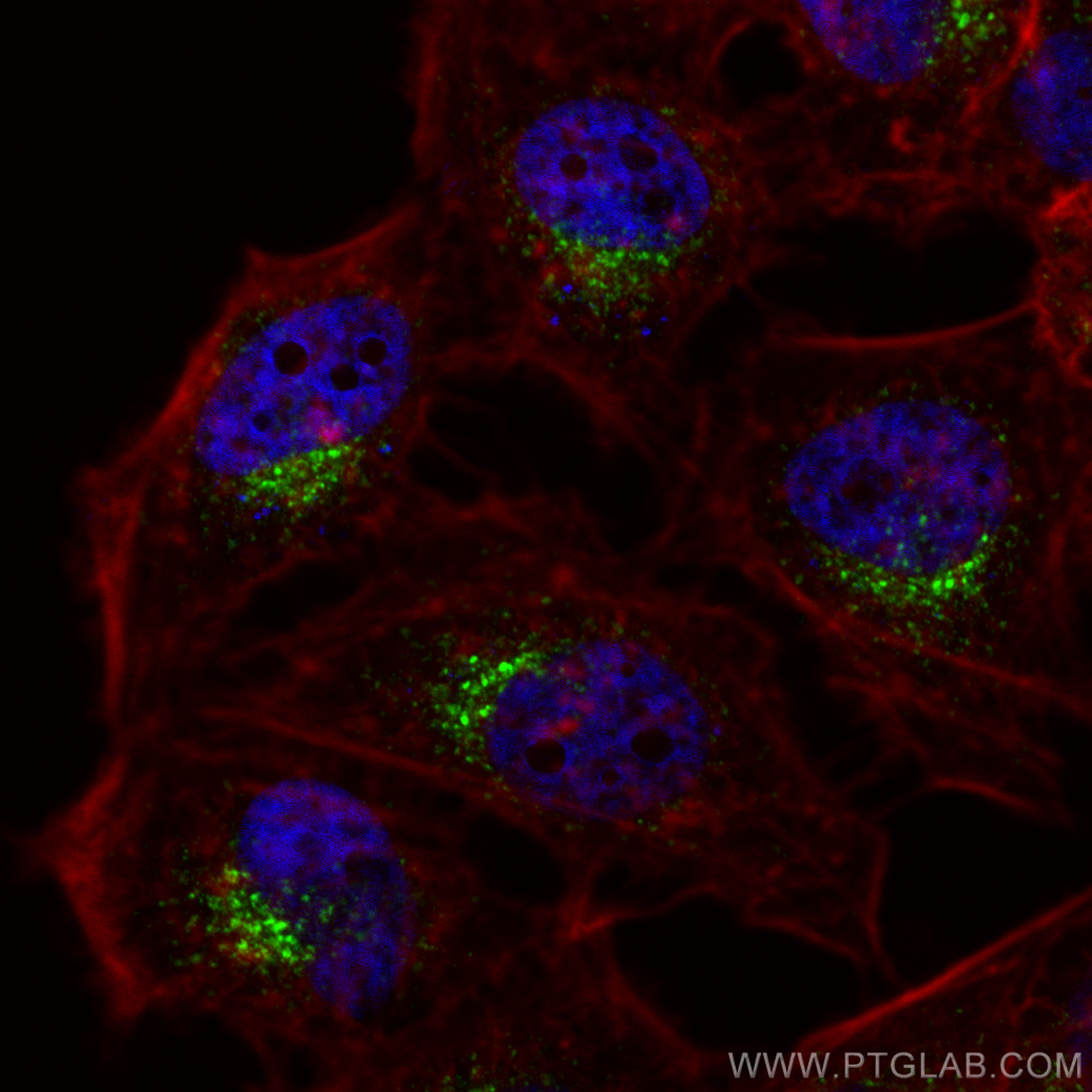 Immunofluorescence (IF) / fluorescent staining of HeLa cells using Sortilin Monoclonal antibody (68007-1-Ig)