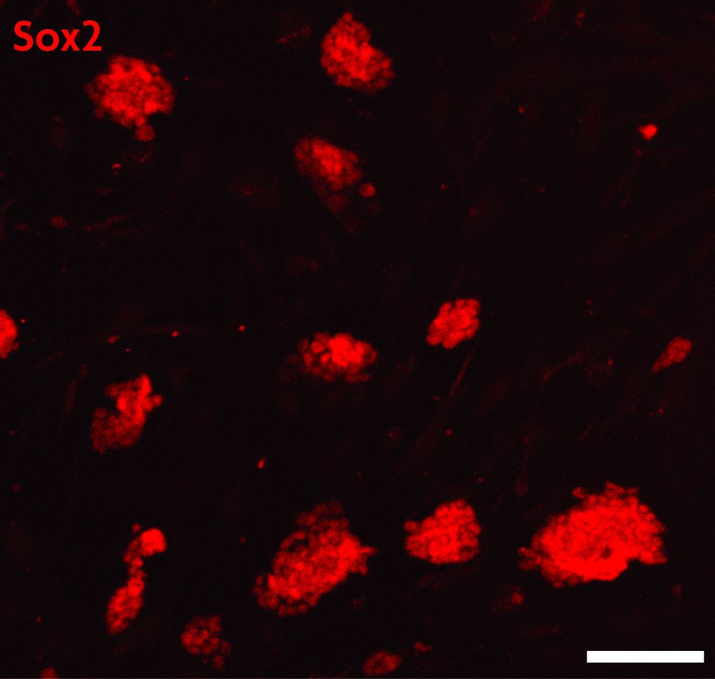 Sox2 antibody (pAb) tested by Immunofluorescence. Mouse embryonic stem cells (mESCs) grown on mouse embryonic fibroblast feeder cells (MEFs) were fixed with 4% paraformaldehyde for 10 minutes at room temperature. Cells were then permeabilized and blocked by incubating with Blocking Solution containing 5% serum/0.1% Triton X-100 in D-PBS for 2 hours at room temperature. Cells were then incubated with Sox2 antibody (Catalog No. 39843, red) at 1:200 dilution overnight at 4°C, washed with D-PBS, and incubated for 2 hours at room temperature with goat anti-mouse Cy3 secondary antibody at 1:250 dilution. Cells were visualized using a Zeiss fluorescent microscope at 20X magnification. Images show that Sox2 antibody specifically stains mESC colonies and does not stain MEFs. Absence of Sox2 staining in a subset of cells within the colonies suggests differentiation. Scale bars, 100 μm.