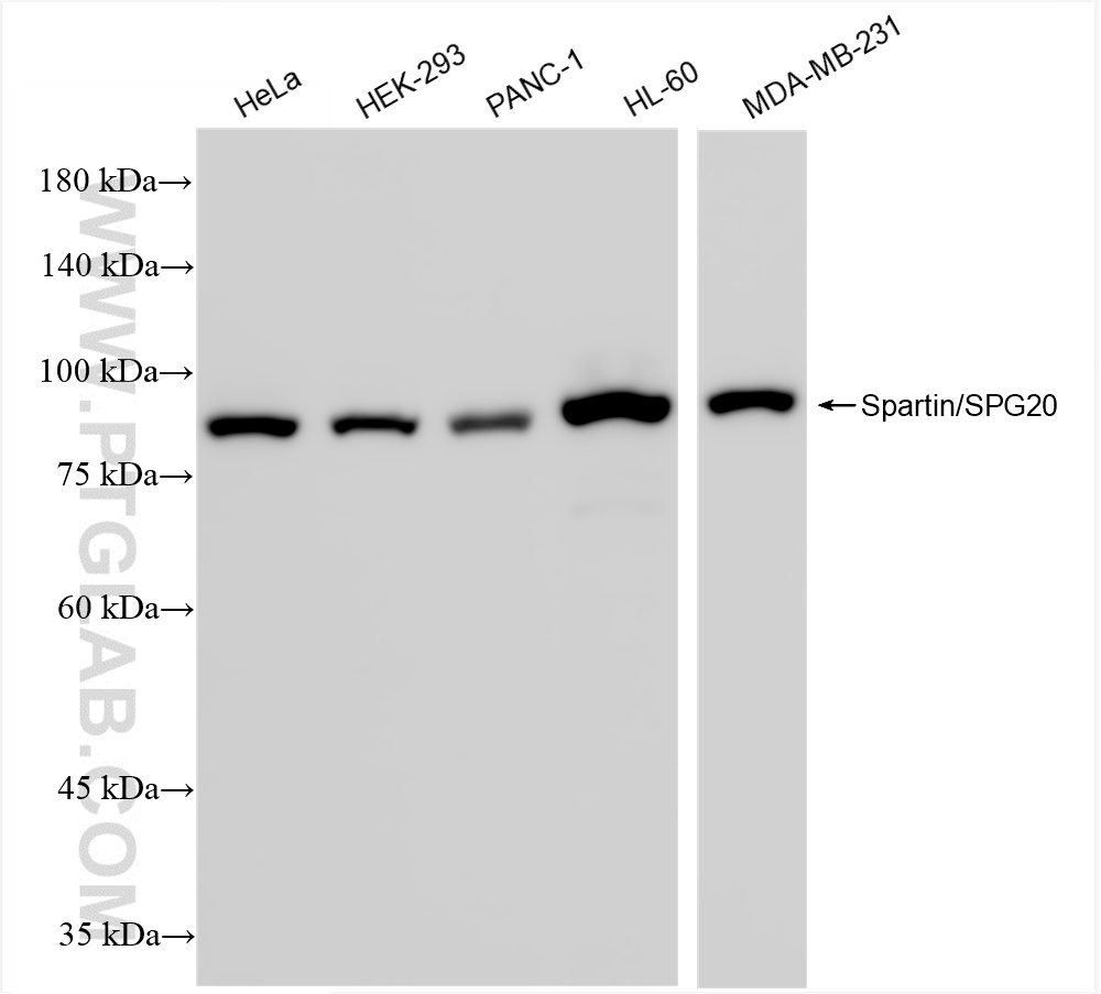 Western Blot (WB) analysis of various lysates using Spartin/SPG20 Recombinant antibody (85938-2-RR)