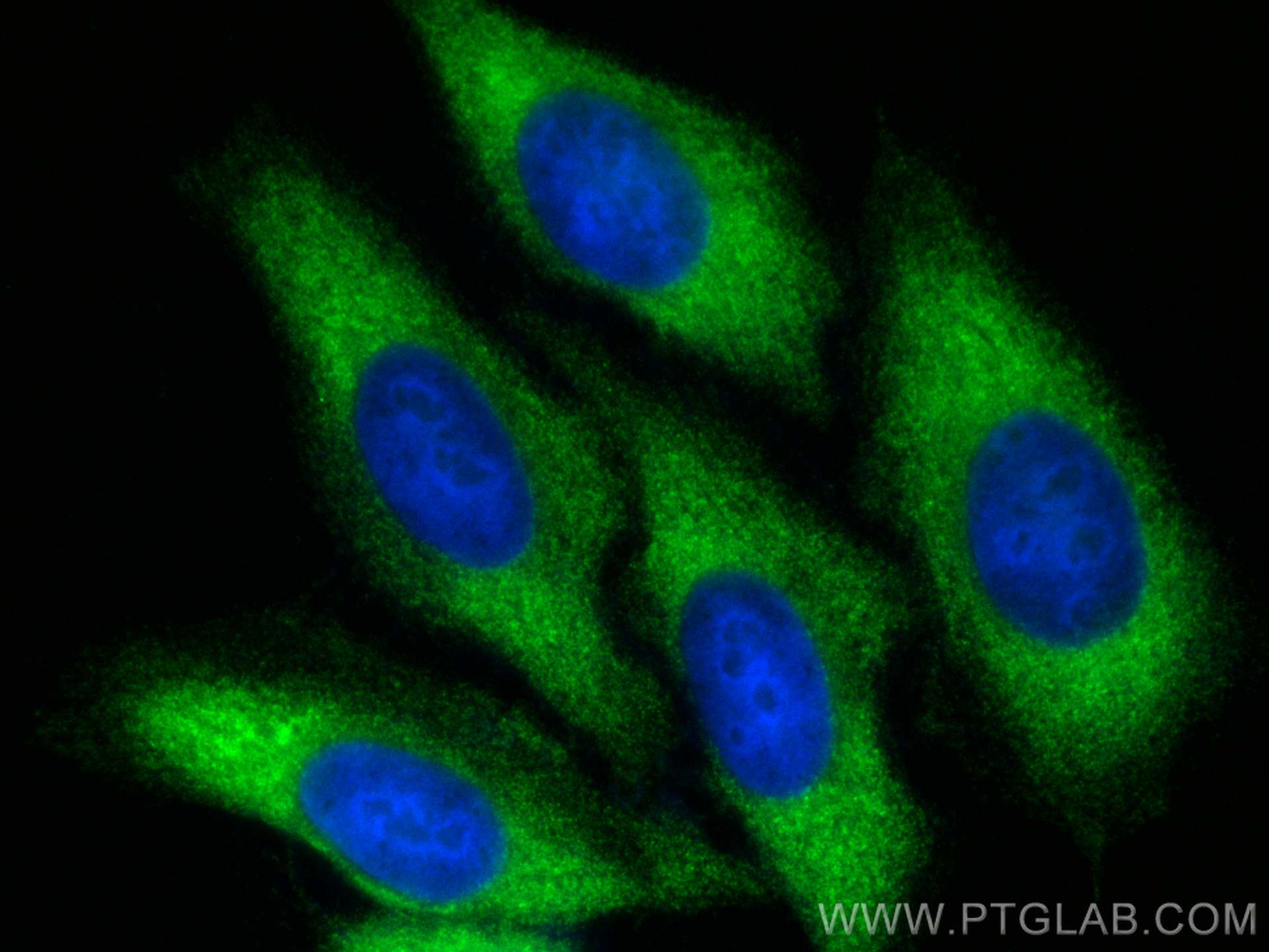 Immunofluorescence (IF) / fluorescent staining of HepG2 cells using CoraLite® Plus 488-conjugated Spartin, SPG20 Polyc (CL488-13791)