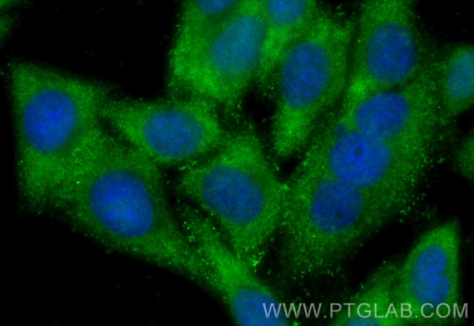 Spermidine synthase