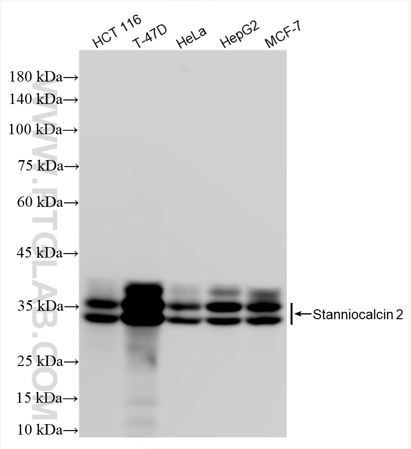 Western Blot (WB) analysis of various lysates using Stanniocalcin 2 Recombinant antibody (85910-1-RR)
