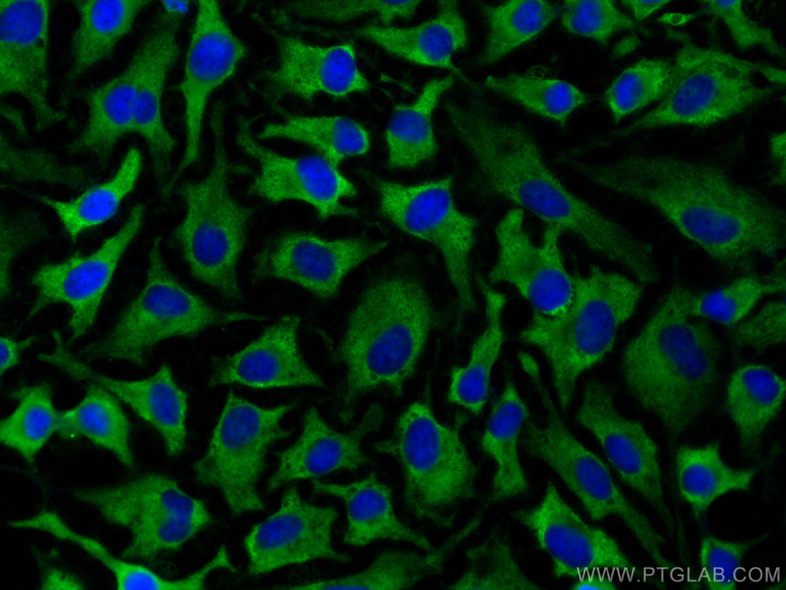 Immunofluorescence (IF) / fluorescent staining of HeLa cells using CoraLite® Plus 488-conjugated Stathmin 1 Recombina (CL488-82559)
