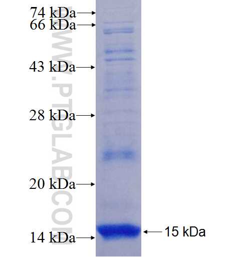 Supervillin fusion protein Ag26201 SDS-PAGE