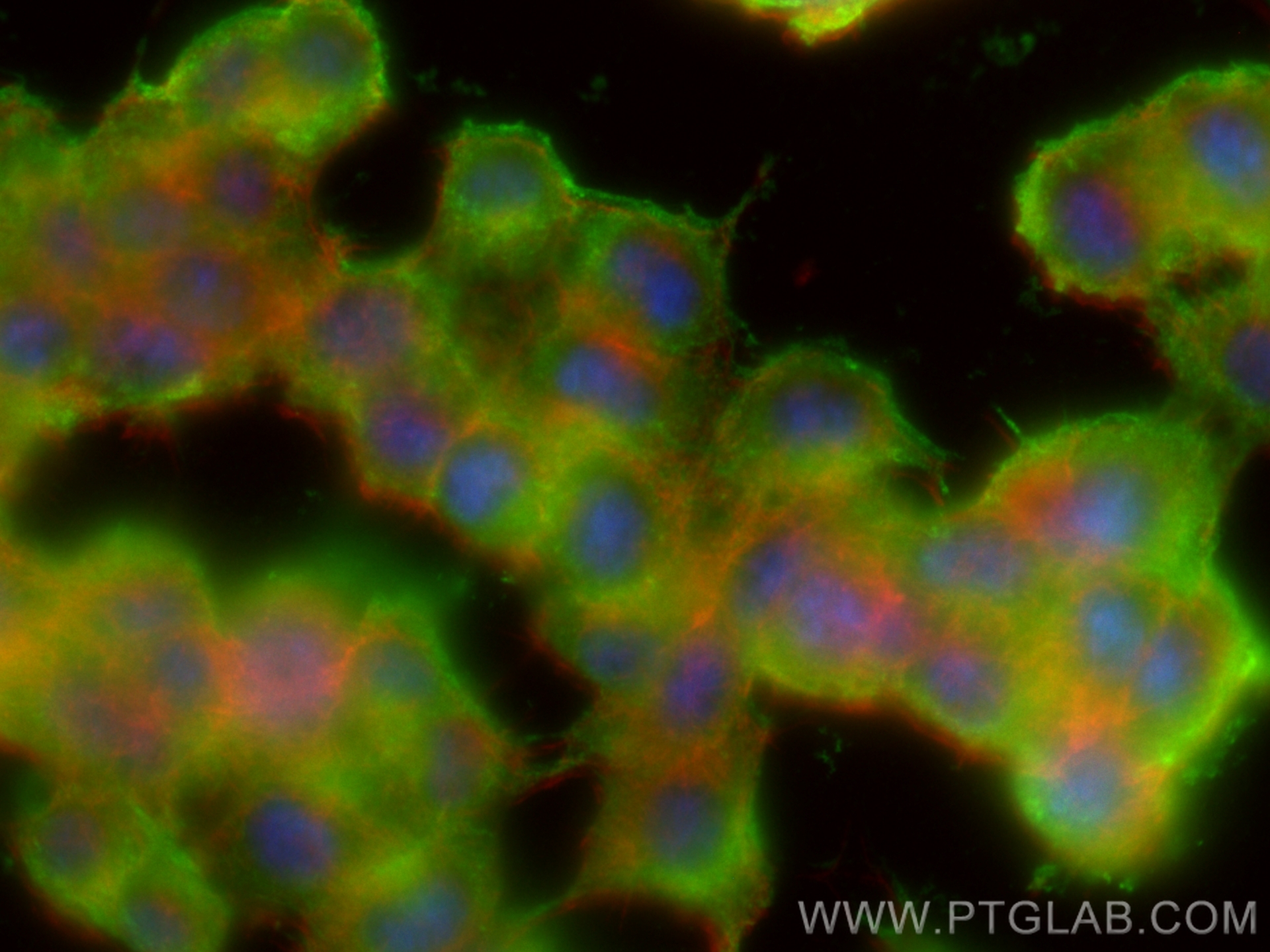 Immunofluorescence (IF) / fluorescent staining of PC-12 cells using Synaptophysin Recombinant antibody (82900-1-RR)