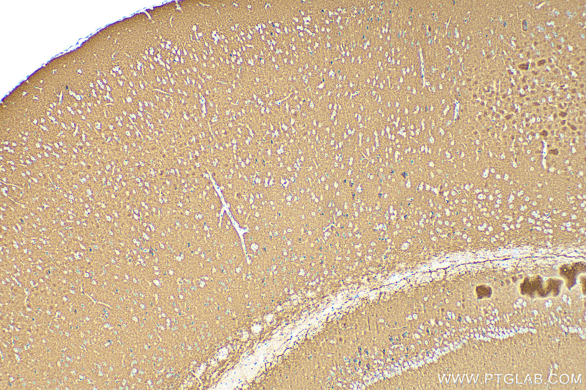 Immunohistochemistry (IHC) staining of mouse brain tissue using Synaptophysin Recombinant antibody (82900-1-RR)