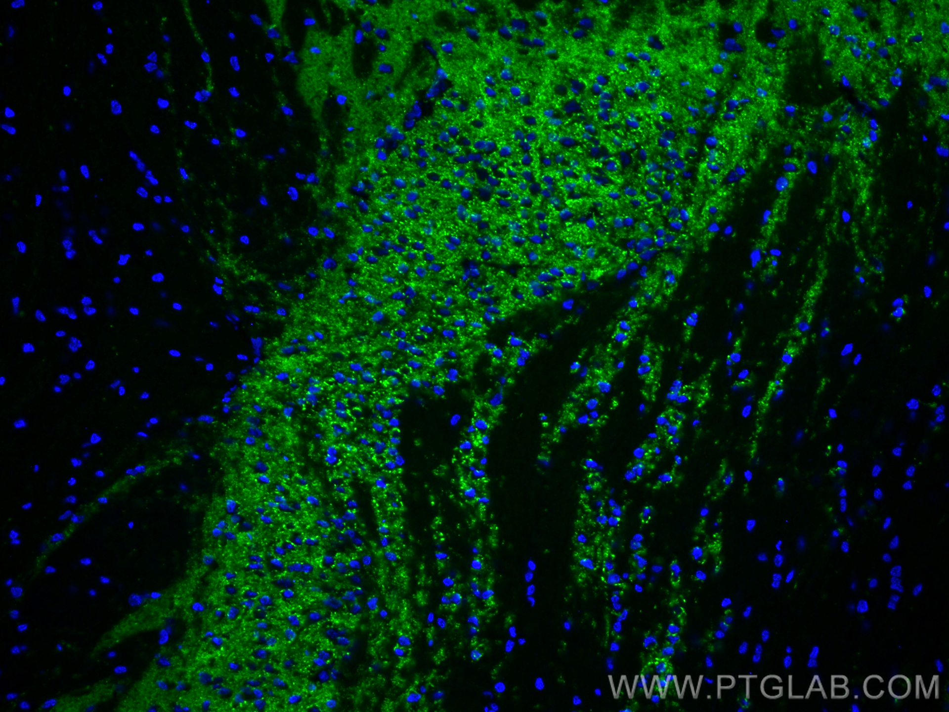 Immunofluorescence (IF) / fluorescent staining of mouse brain tissue using CoraLite® Plus 488-conjugated Synaptophysin Recomb (CL488-82900)