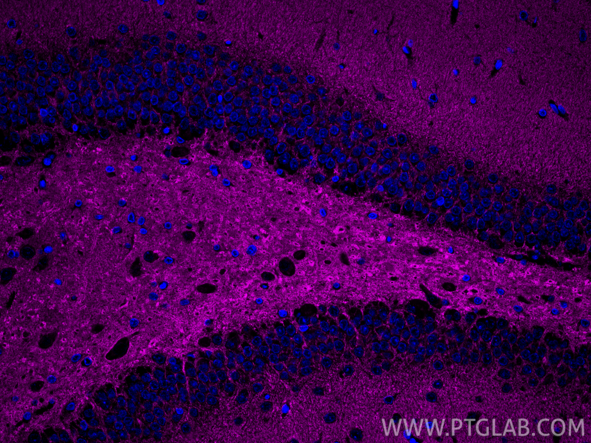 Immunofluorescence (IF) / fluorescent staining of rat brain tissue using CoraLite® Plus 647-conjugated Synaptophysin Polycl (CL647-17785)