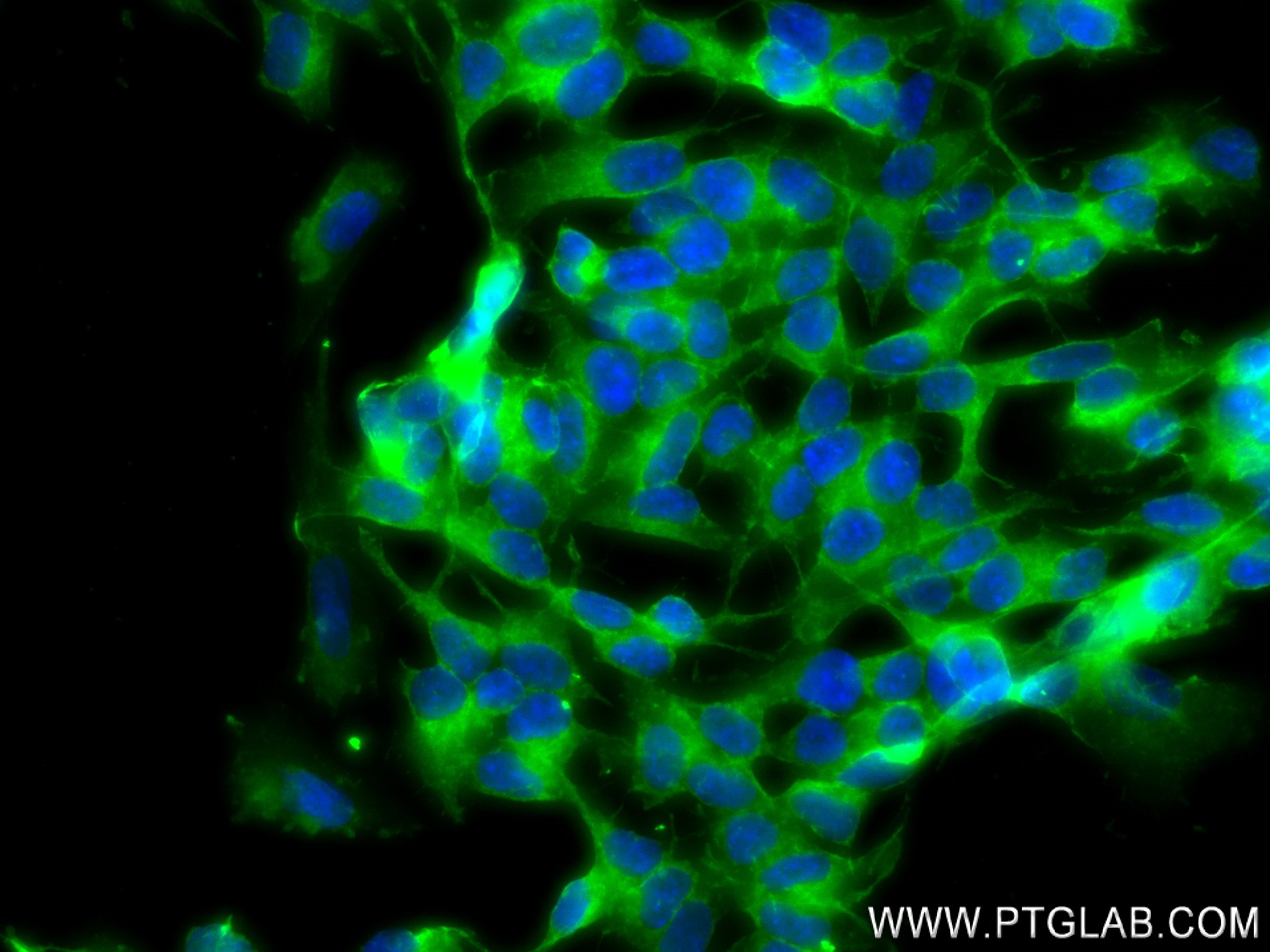 Immunofluorescence (IF) / fluorescent staining of SH-SY5Y cells using Synaptotagmin-1 Recombinant antibody (83637-4-RR)