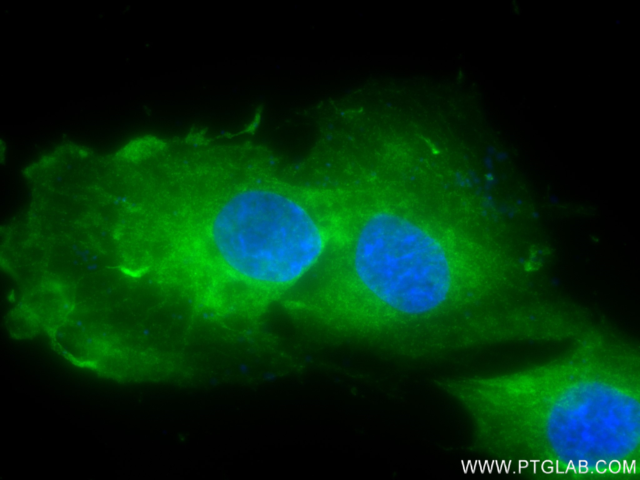 Immunofluorescence (IF) / fluorescent staining of SH-SY5Y cells using Synaptotagmin-1 Recombinant antibody (83637-4-RR)