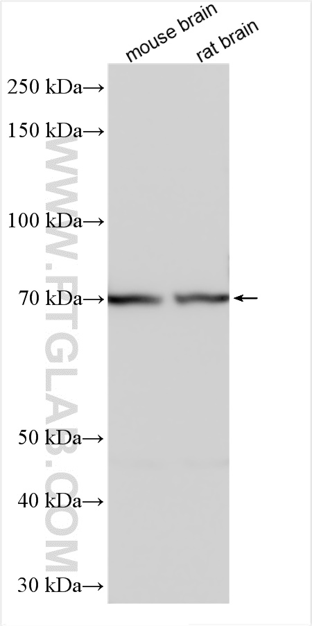 Western Blot (WB) analysis of various lysates using Synaptotagmin-10 Polyclonal antibody (20881-1-AP)