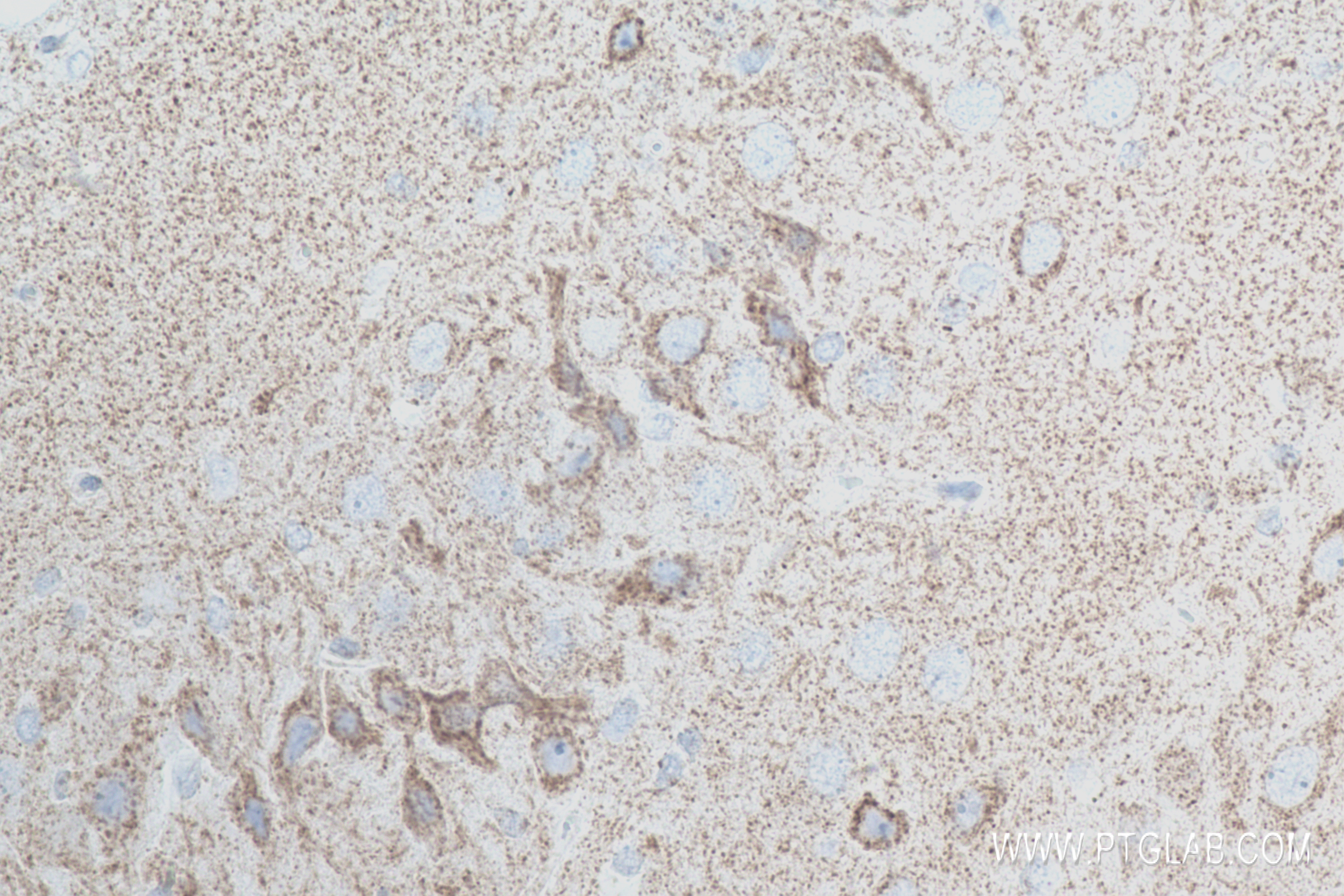 Immunohistochemistry (IHC) staining of rat brain tissue using Synaptotagmin-5 Recombinant antibody (84452-1-RR)
