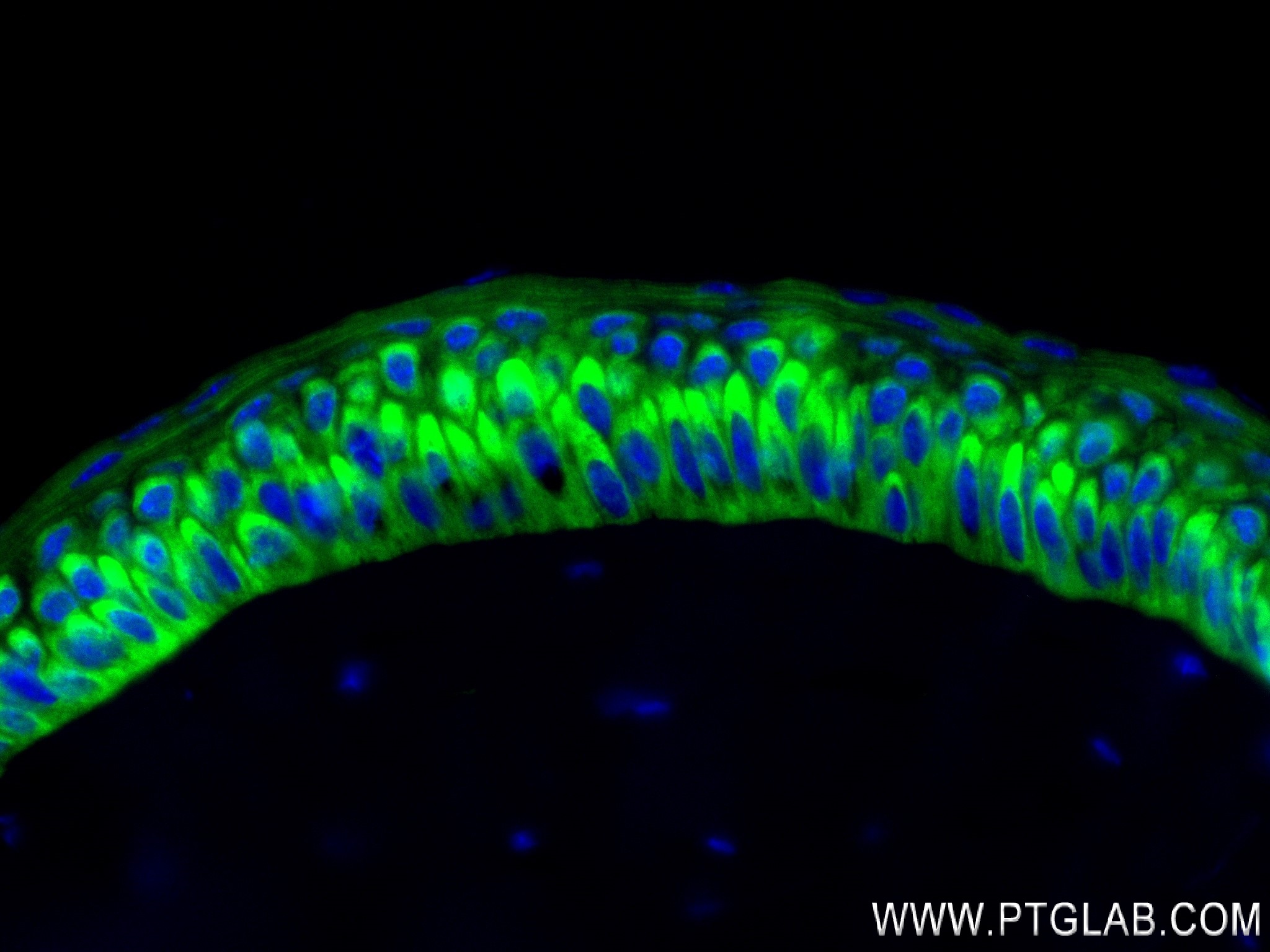 Immunofluorescence (IF) / fluorescent staining of mouse retina tissue using Synaptotagmin-9 Recombinant antibody (84123-3-RR)