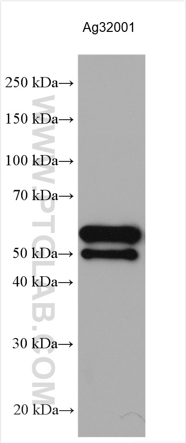 Western Blot (WB) analysis of Recombinant protein using T7 RNA polymerase Polyclonal antibody (29943-1-AP)