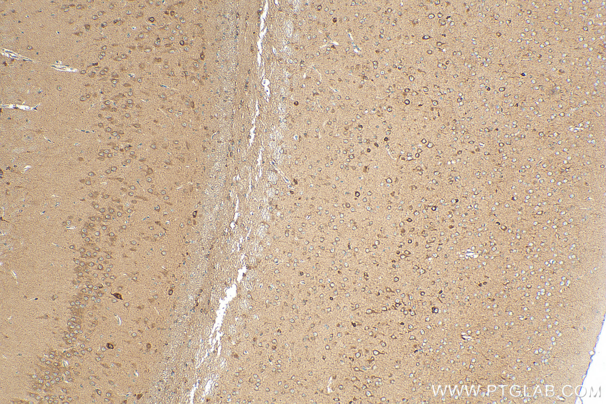 Immunohistochemistry (IHC) staining of mouse brain tissue using TAC1 Polyclonal antibody (28599-1-AP)