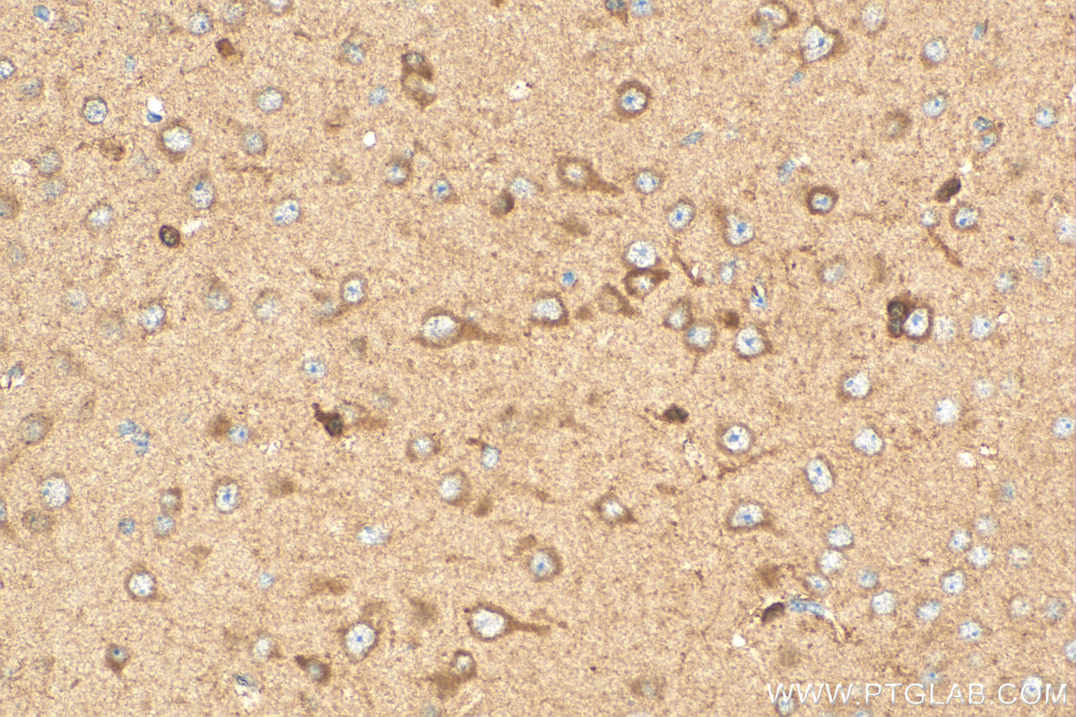 Immunohistochemistry (IHC) staining of mouse brain tissue using TAC1 Polyclonal antibody (28599-1-AP)