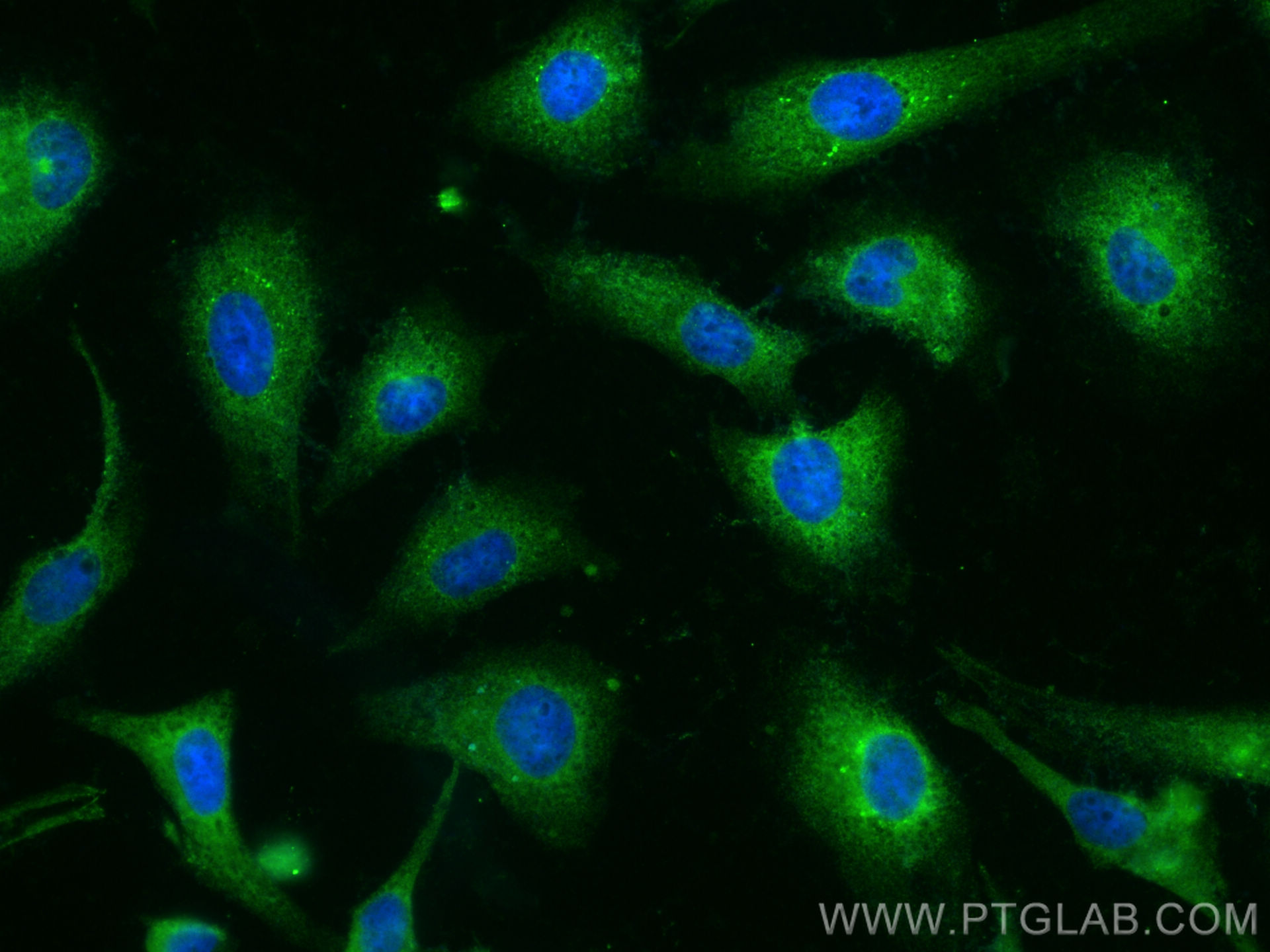 Immunofluorescence (IF) / fluorescent staining of HeLa cells using TACC1 Polyclonal antibody (13862-1-AP)