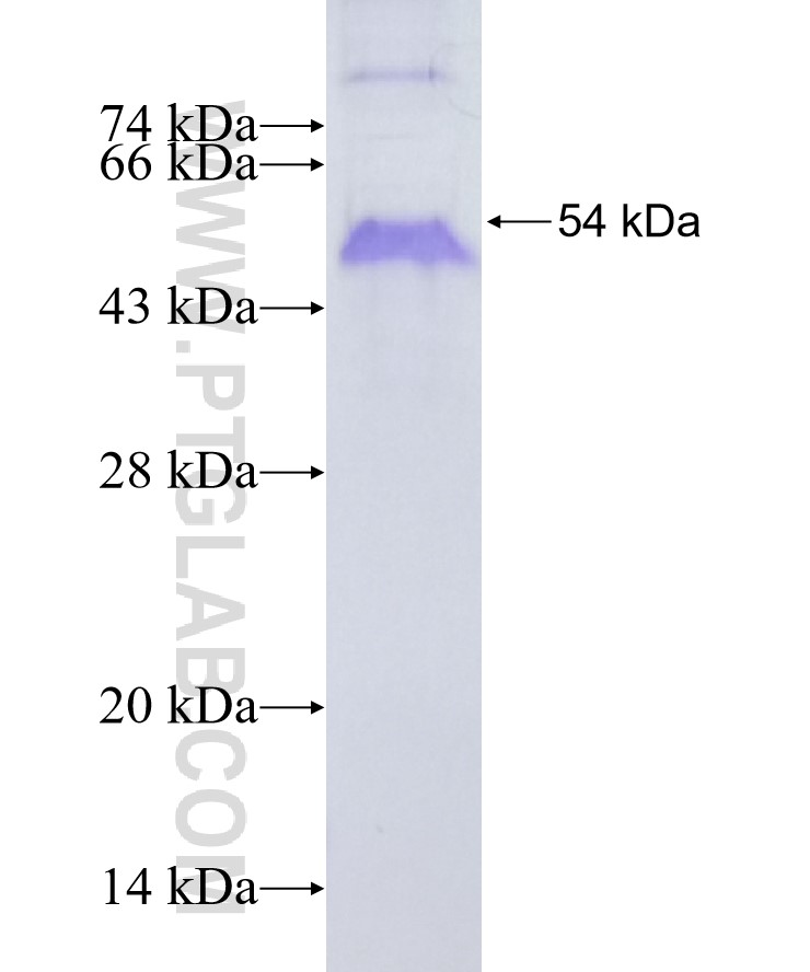 TACC3 fusion protein Ag23037 SDS-PAGE