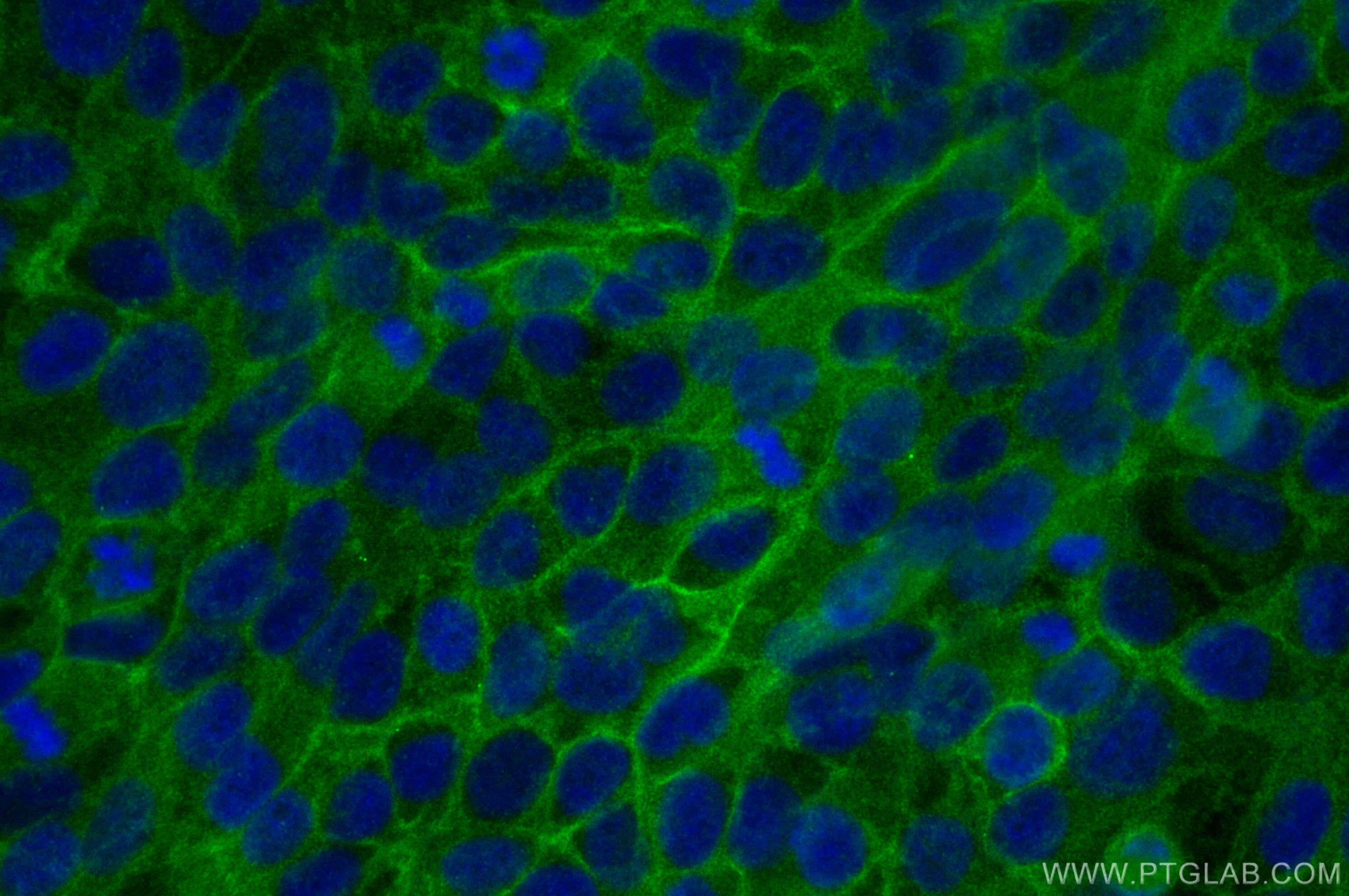 Immunofluorescence (IF) / fluorescent staining of HaCaT cells using TACSTD2/TROP2 Polyclonal antibody (27360-1-AP)