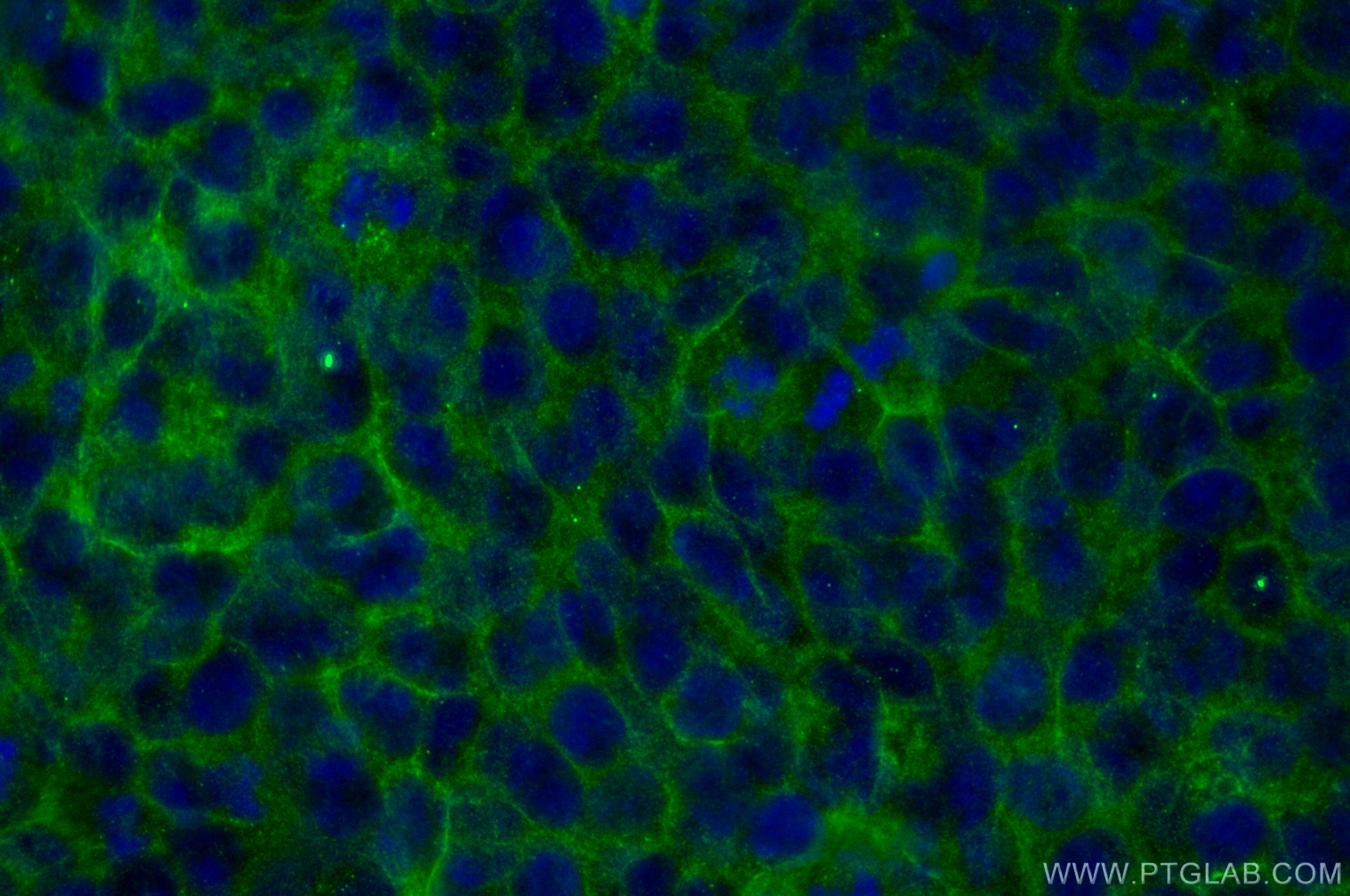 Immunofluorescence (IF) / fluorescent staining of HaCaT cells using TACSTD2/TROP2 Monoclonal antibody (68141-1-Ig)