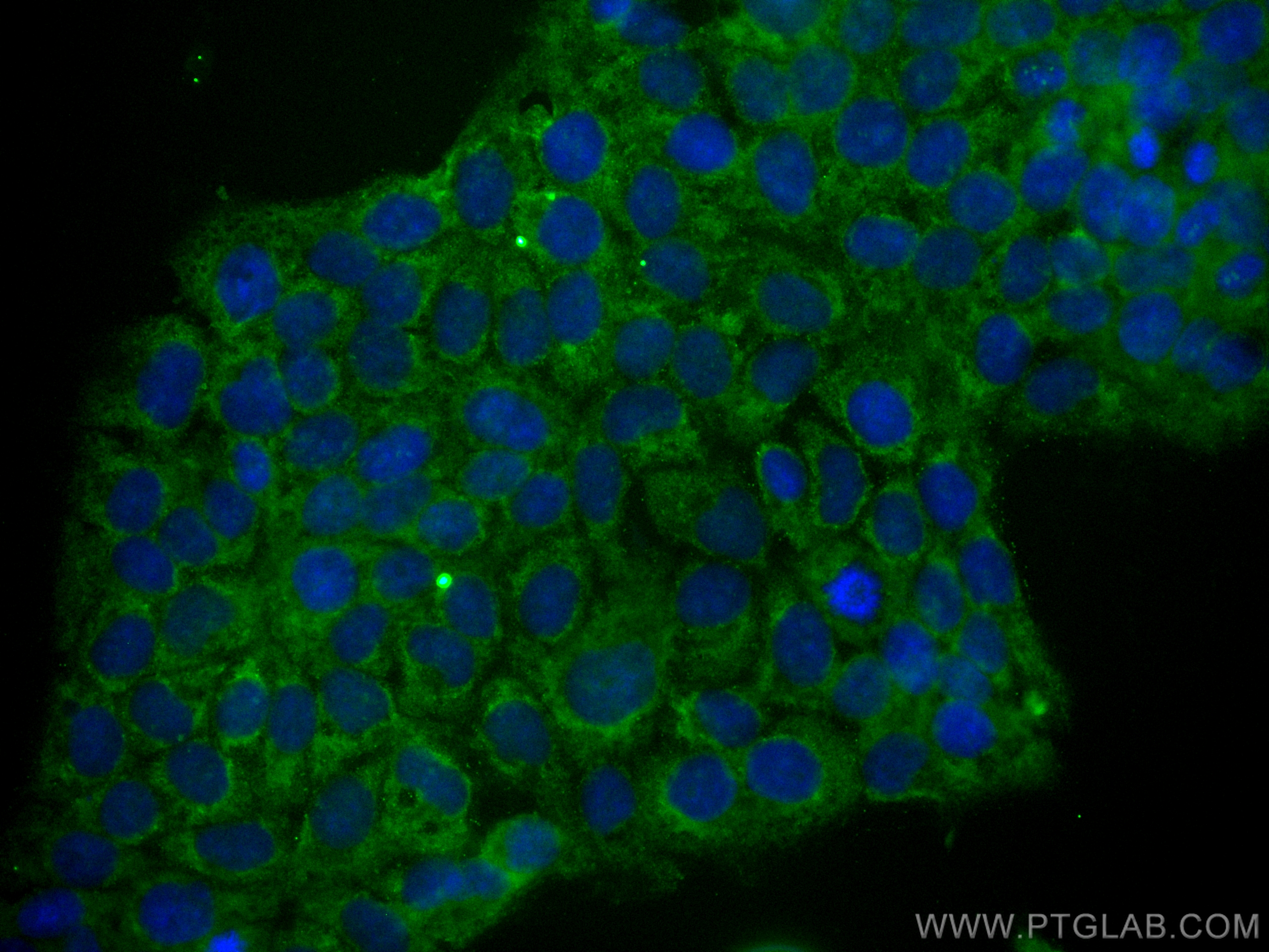 Immunofluorescence (IF) / fluorescent staining of HaCaT cells using CoraLite® Plus 488-conjugated TACSTD2/TROP2 Monocl (CL488-68141)