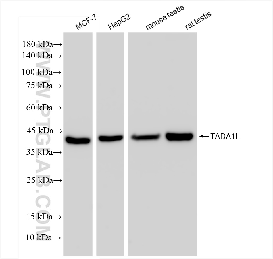 Western Blot (WB) analysis of various lysates using TADA1L Recombinant antibody (83641-4-RR)