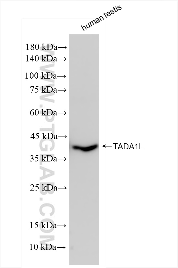 Western Blot (WB) analysis of human testis tissue using TADA1L Recombinant antibody (83641-4-RR)