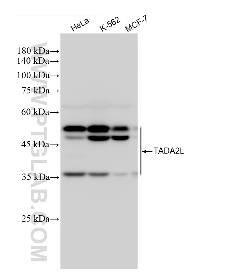 Western Blot (WB) analysis of various lysates using TADA2L Recombinant antibody (84227-2-RR)