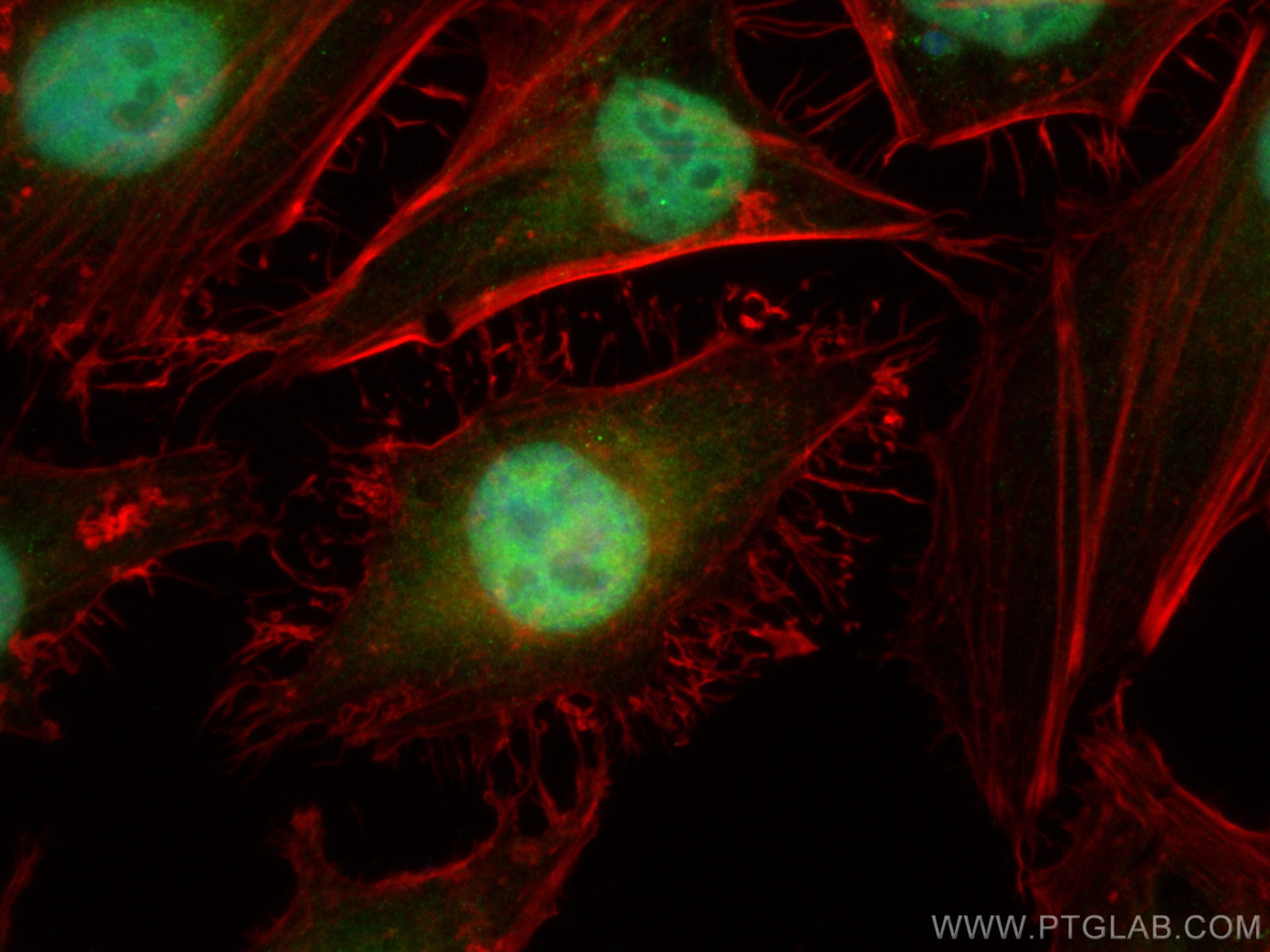 Immunofluorescence (IF) / fluorescent staining of HeLa cells using TAF15 Polyclonal antibody (24235-1-AP)