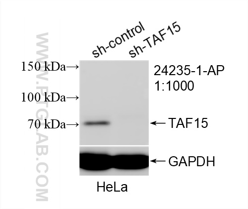 Western Blot (WB) analysis of HeLa cells using TAF15 Polyclonal antibody (24235-1-AP)