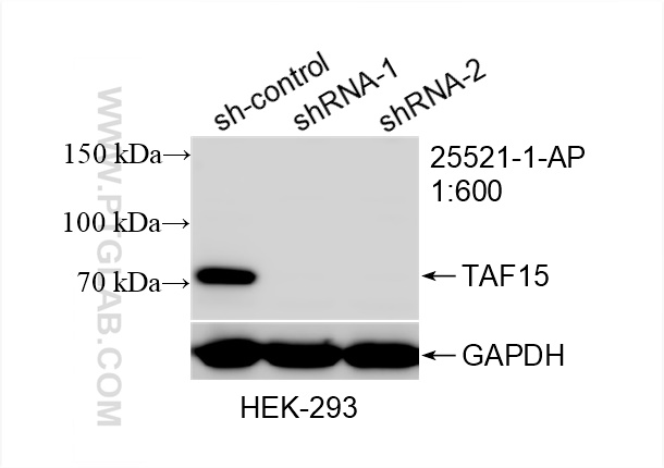 Western Blot (WB) analysis of HEK-293 cells using TAF15 Polyclonal antibody (25521-1-AP)