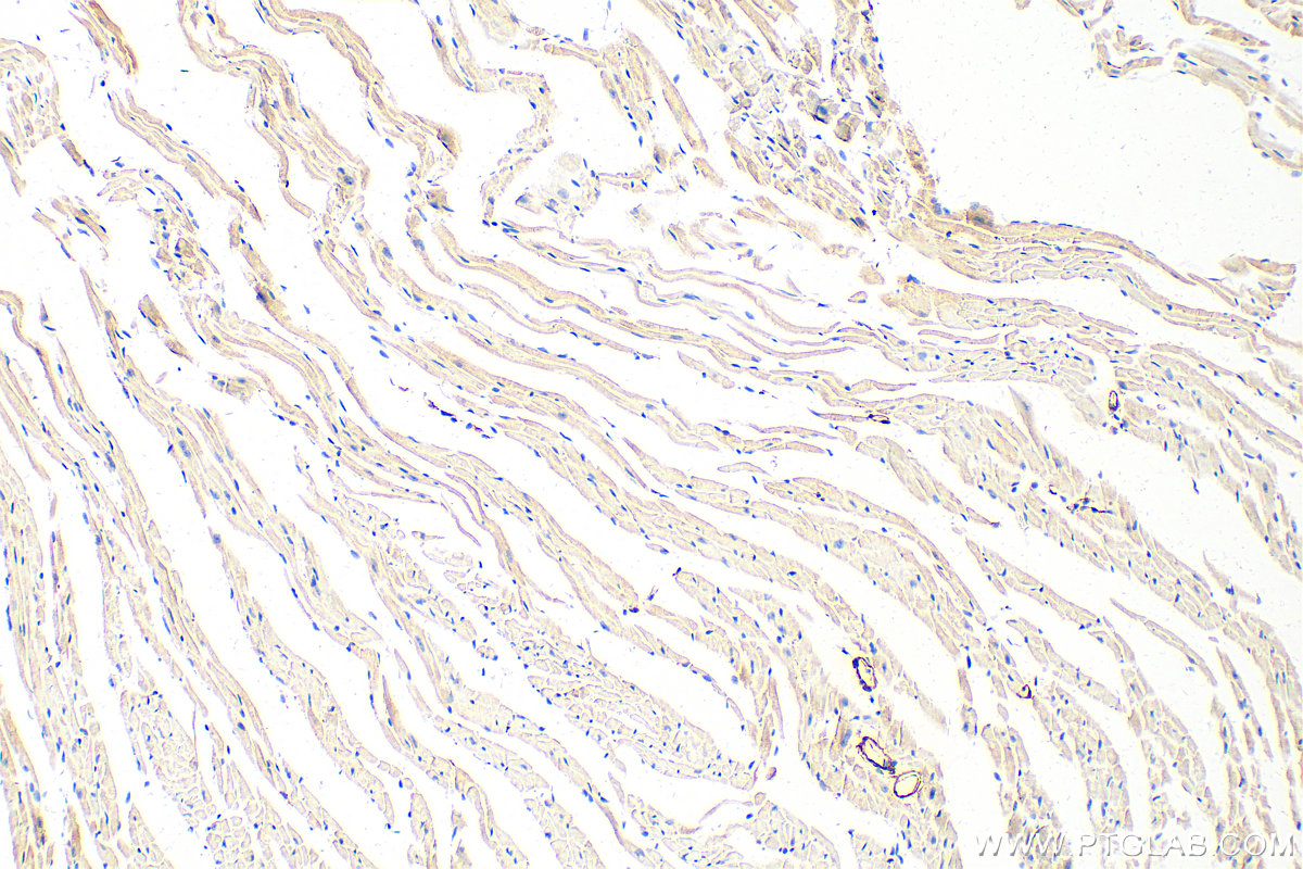 Immunohistochemistry (IHC) staining of mouse heart tissue using transgelin/SM22 Polyclonal antibody (10493-1-AP)