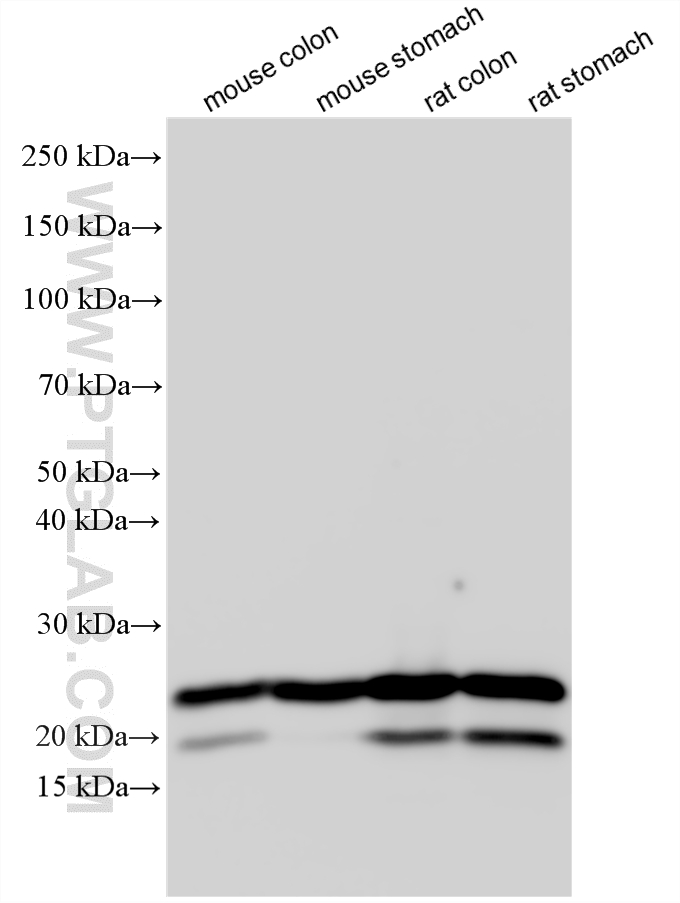Western Blot (WB) analysis of various lysates using transgelin/SM22 Polyclonal antibody (10493-1-AP)