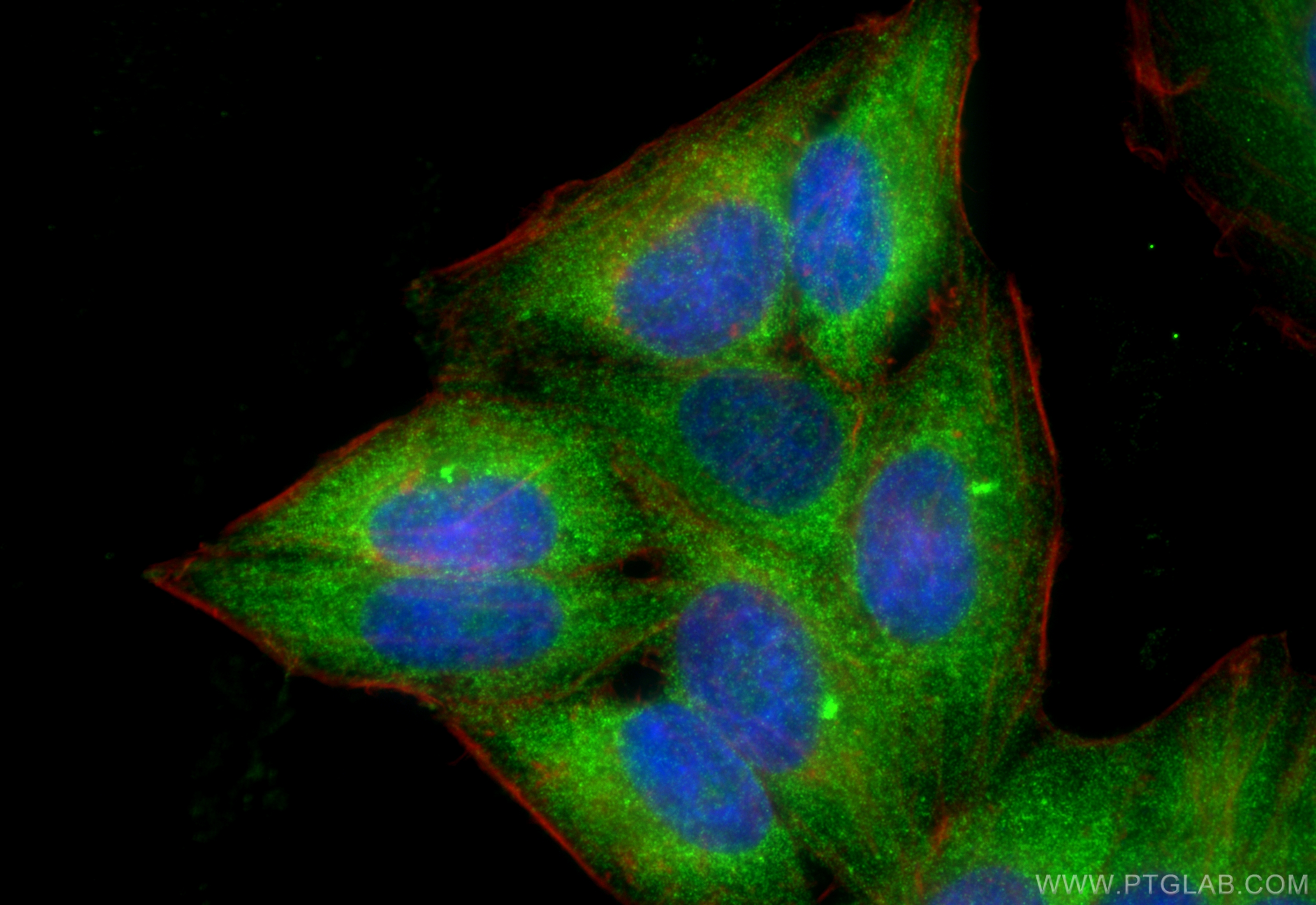 Immunofluorescence (IF) / fluorescent staining of HepG2 cells using Transgelin 2 Polyclonal antibody (10234-2-AP)