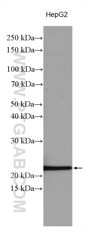 Western Blot (WB) analysis of various lysates using Transgelin 2 Polyclonal antibody (10234-2-AP)