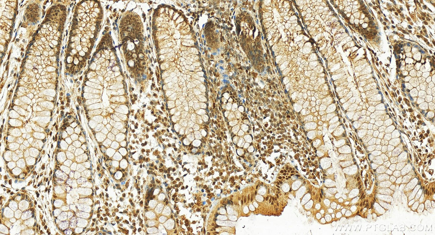 Immunohistochemistry (IHC) staining of human colon tissue using TALDO1 Polyclonal antibody (12376-1-AP)