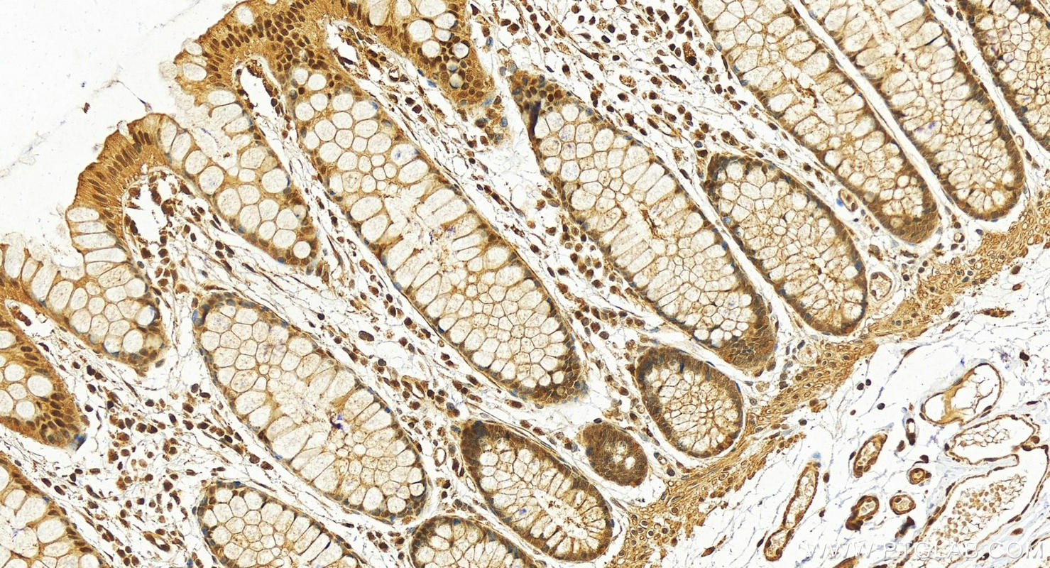 Immunohistochemistry (IHC) staining of human colon tissue using TALDO1 Polyclonal antibody (12376-1-AP)