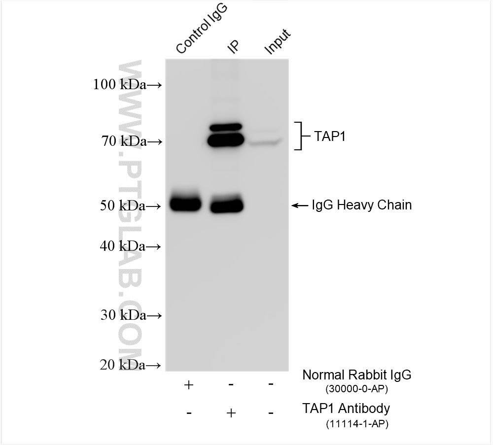 Immunoprecipitation (IP) experiment of HepG2 cells using TAP1 Polyclonal antibody (11114-1-AP)