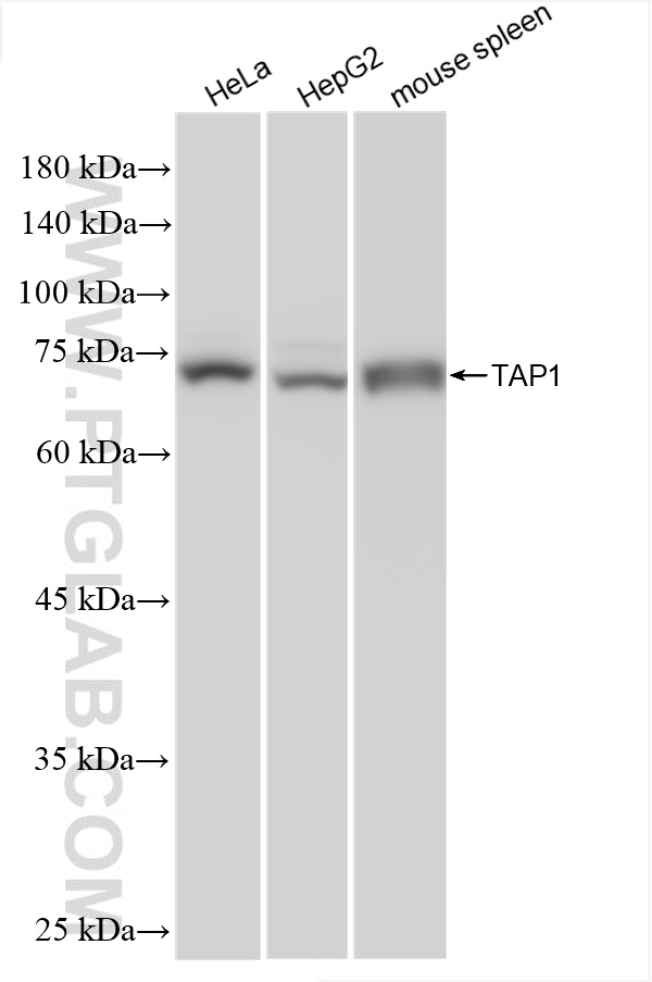 Western Blot (WB) analysis of various lysates using TAP1 Recombinant antibody (85766-4-RR)