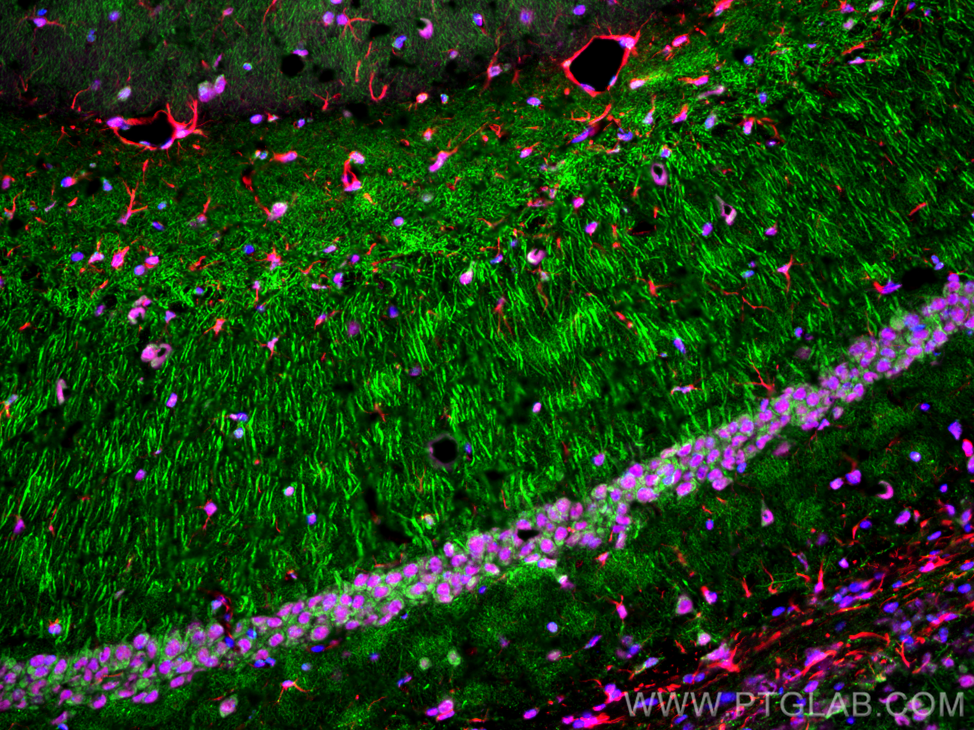 Immunofluorescence (IF) / fluorescent staining of mouse brain tissue using TDP-43 Polyclonal antibody (10782-2-AP)