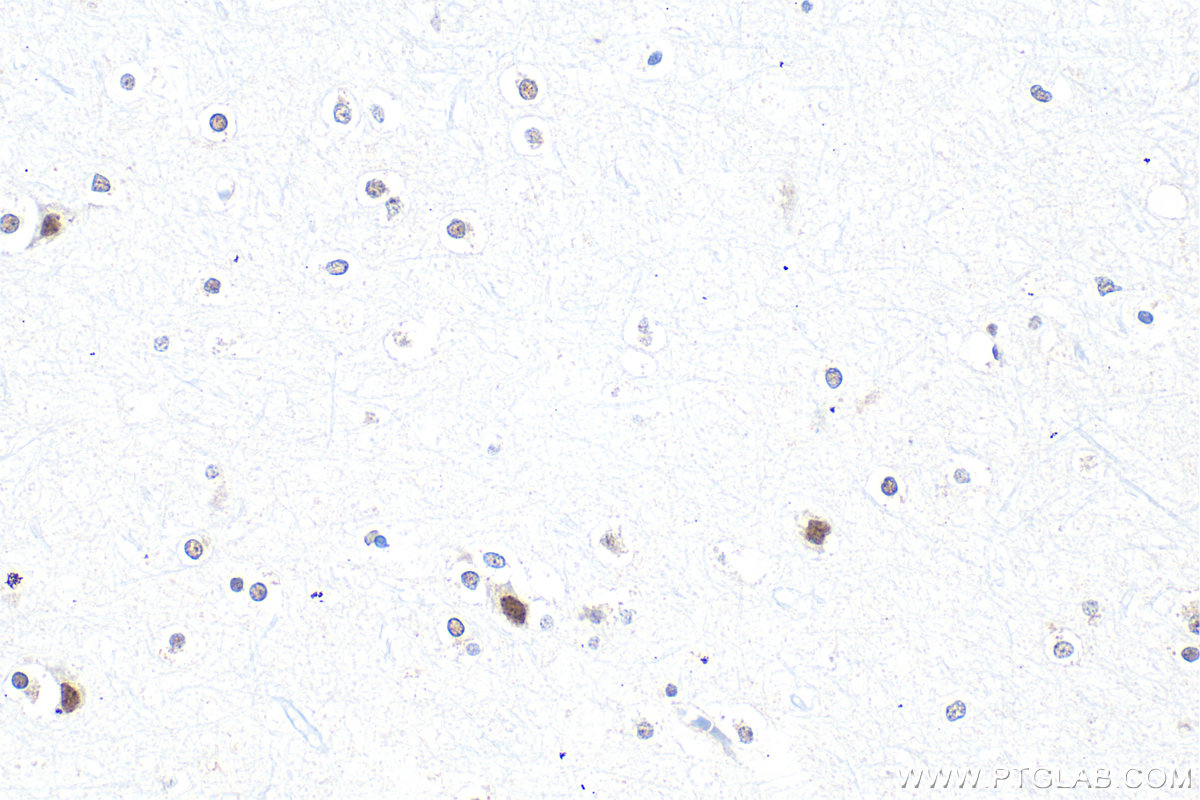 Immunohistochemistry (IHC) staining of human brain tissue using TDP-43 Polyclonal antibody (10782-2-AP)