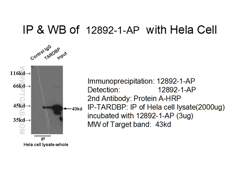 TDP-43 (C-terminal)