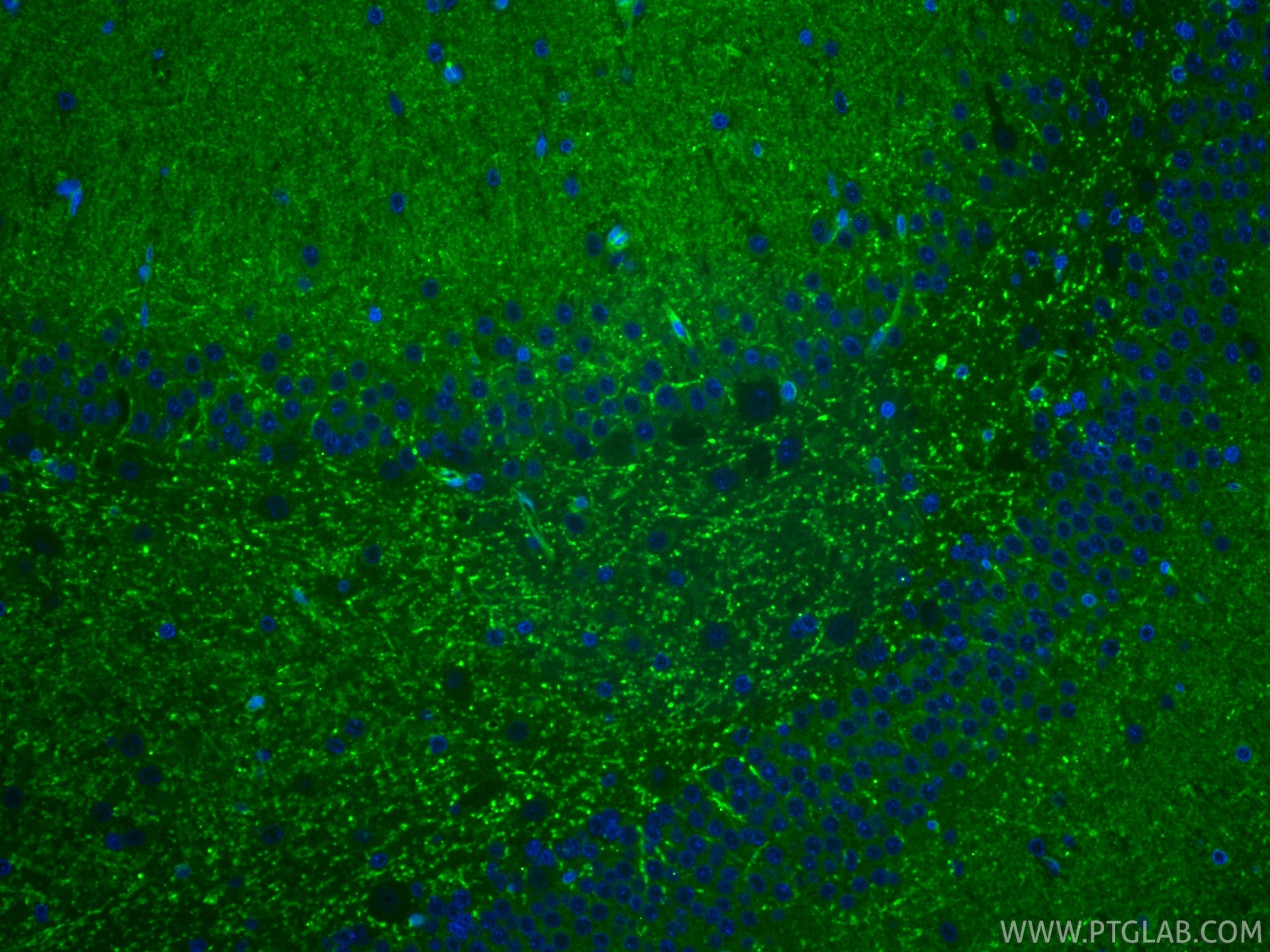 Immunofluorescence (IF) / fluorescent staining of rat brain tissue using TAU Monoclonal antibody (66499-1-Ig)