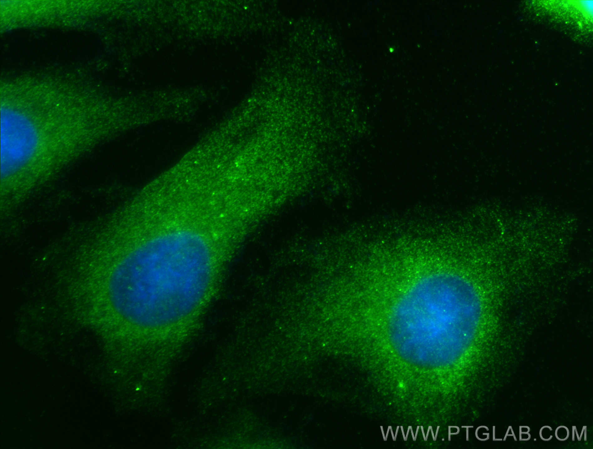 Immunofluorescence (IF) / fluorescent staining of HeLa cells using TAX1BP1 Polyclonal antibody (14424-1-AP)