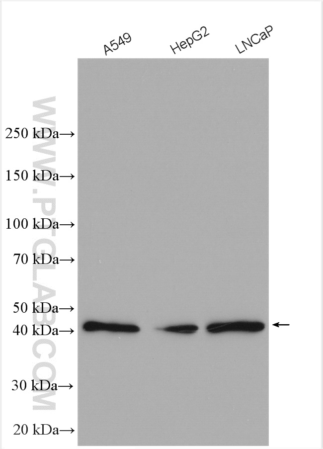 Western Blot (WB) analysis of various lysates using TBC1D20 Polyclonal antibody (16464-1-AP)